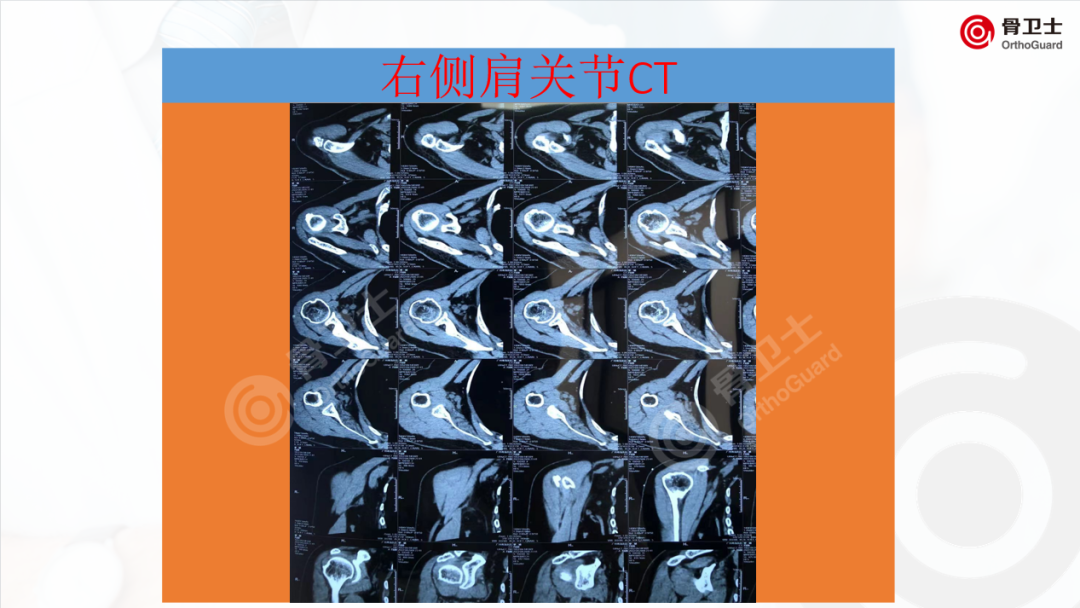97ff445fce56e1431bd315bc43d26eff_640_wx_fmt=png&wxfrom=5&wx_lazy=1&wx_co=1.png